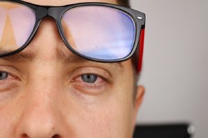Why Does Weed Make Your Eyes Red